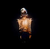 Bones