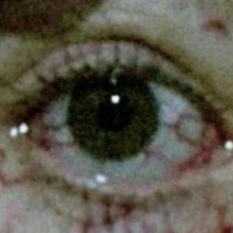 BLOODSHOT