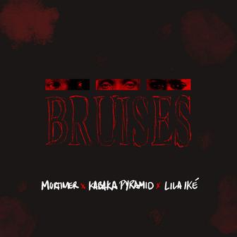 Bruises